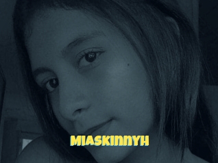 Miaskinnyh