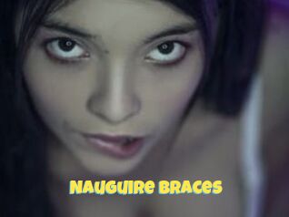 Nauguire_braces